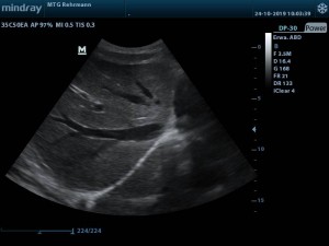 MTG DP 30 Leber