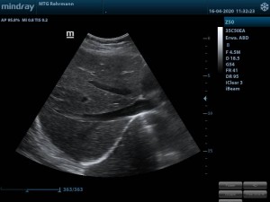 MTG Z50 Leber