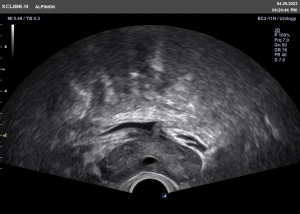 X CUBEi9 Prostata